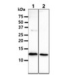 Western blot of human B2M protein detected with anti-human beta-2-microglobulin antibody in HeLa and U937 cell lysates