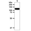 Western blot of human EphA2 protein in PC3 cell lysate using STJA0041815 antibody