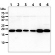 Western blot of Human NM23-H1 NME1 antibody STJA0041834 across multiple cell lysates