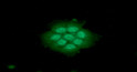 ICC IF of CTGF in Hep3B cells with STJA0041841 antibody Alexa Fluor 488 secondary green DAPI nuclear stain blue
