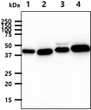 Western blot of human CHI3L2 antibody STJA0041845 showing detection in 293T HeLa HepG2 and LnCap cell lysates