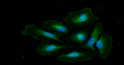 Western blot of Human Glutamine Synthetase antibody STJA0041847 showing protein detection