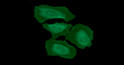 ICC IF of human Integrin beta 1 CD29 in HeLa cells with Alexa Fluor 488 and DAPI