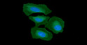 Western blot of Human Integrin beta 1 CD29 antibody STJA0041858