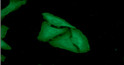ICC IF of FHL2 in HeLa cells with STJA0041859 antibody Alexa Fluor 488 secondary and DAPI nuclear stain