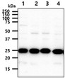 Western blot of human HPRT antibody showing HeLa MCF7 293T and A549 cell lysates