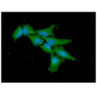 ICC IF of ODC1 in HeLa cells with Alexa Fluor 488 and DAPI staining