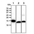 Western blot of human FABP1 L-FABP protein using STJA0041894 antibody