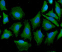 ICC IF of CNDP2 CPGL in HeLa cells stained with STJA0041935 antibody Alexa Fluor 488 and DAPI