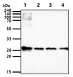Western blot of human CTLA4 antibody showing mouse liver TF-1 HepG2 and WiDr cell lysates