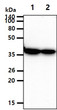 Western blot of human ACAT2 protein in HepG2 and Ramos cell lysates
