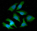 ICC IF of NM23-H1 in HeLa cells stained with STJA0041958 antibody Alexa Fluor 488 secondary DAPI nuclear stain