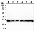 Western blot of human NM23-H1 NME1 protein expression across multiple cell lines