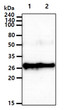 Western blot of recombinant human RalA and RalB proteins using anti-human RalA RalB antibody