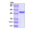 SDS-PAGE of recombinant human adenylate kinase 2 protein under reducing conditions