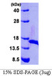 SDS-PAGE gel of recombinant E.coli dsbE protein 3μg under reducing conditions with Coomassie stain