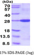 SDS-PAGE gel of recombinant human Bcl-2 protein under reducing conditions Coomassie blue stain