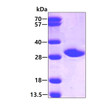 SDS-PAGE gel showing recombinant human NNMT protein under reducing conditions stained with Coomassie blue