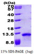 SDS-PAGE gel of recombinant human CCL17 TARC protein under reducing conditions