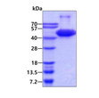 SDS-PAGE gel of recombinant human Aurora B protein 3 μg reducing conditions Coomassie blue stain