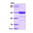 SDS-PAGE gel showing recombinant human AKR1A1 protein under reducing conditions stained with Coomassie blue