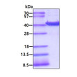 SDS-PAGE gel of recombinant human AKR7A3 protein stained with Coomassie blue