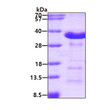 SDS-PAGE gel of recombinant human ASPH protein under reducing conditions Coomassie blue stain