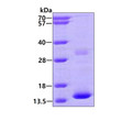 SDS-PAGE gel of recombinant human Hemoglobin zeta HBZ protein under reducing conditions