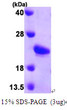 SDS-PAGE of recombinant mouse Sonic Hedgehog Shh protein under reducing conditions