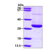 SDS-PAGE gel of recombinant human RAN protein 3μg under reducing conditions stained with Coomassie blue