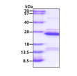 SDS-PAGE gel of recombinant human COMMD1 protein under reducing conditions Coomassie blue stain