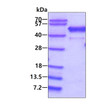 SDS-PAGE gel of recombinant human p47phox NCF1 protein stained with Coomassie blue