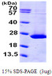 SDS-PAGE gel of recombinant human ARFL1 ARL1 protein under reducing conditions