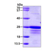 SDS-PAGE gel of recombinant human CBFB protein 3µg under reducing conditions with Coomassie blue staining