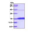 SDS-PAGE gel of recombinant human CDA protein 3 µg under reducing conditions Coomassie blue stain
