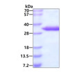 SDS-PAGE gel of recombinant human UCK2 protein stained with Coomassie blue