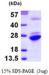 SDS-PAGE gel of recombinant human GNPNAT1 protein under reducing conditions stained with Coomassie blue