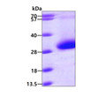 SDS-PAGE gel of recombinant human CDKN3 protein under reducing conditions stained with Coomassie blue