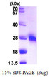 SDS-PAGE gel of recombinant human GGCT protein 3 µg under reducing conditions with Coomassie blue staining