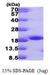 SDS-PAGE gel of recombinant human NME3 protein under reducing conditions stained with Coomassie blue