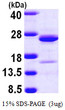 SDS-PAGE gel of recombinant human NCALD protein under reducing conditions