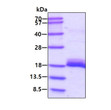 SDS-PAGE gel of recombinant human Calcineurin B protein 3µg Coomassie stain