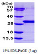 SDS-PAGE of recombinant human RAB21 protein under reducing conditions Coomassie blue stain