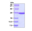 SDS-PAGE of recombinant mouse DHFR protein under reducing conditions Coomassie stain