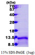 SDS-PAGE gel of recombinant human CCL3L1 LD78-beta protein 3µg reducing conditions Coomassie blue stain
