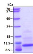 SDS-PAGE of recombinant human CCL20 MIP-3 alpha protein under reducing conditions