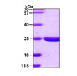 SDS-PAGE gel of recombinant human LYPLA2 protein under reducing conditions stained with Coomassie blue