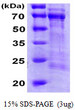 SDS-PAGE of recombinant human CDC25A protein under reducing conditions