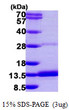 SDS-PAGE gel of recombinant human DYNLRB2 protein under reducing conditions stained with Coomassie blue