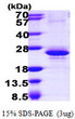 SDS-PAGE gel electrophoresis of recombinant human RBM8A protein STJP017127